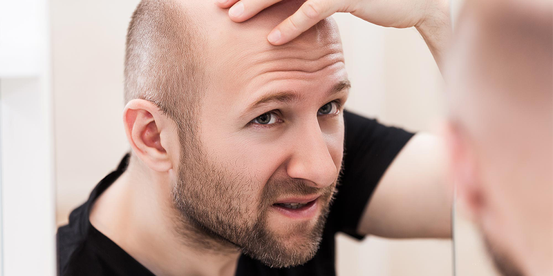 Stem Cell Hair Transplant