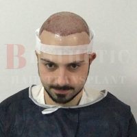 hair-transplantation-patient-references_6 hair-transplantation-patient-references_6